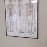 Chiropractic posters charts framed